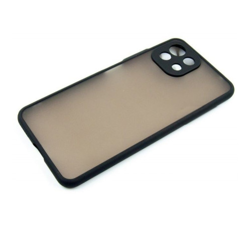 Чохол до мобільного телефона Dengos Matte Xiaomi 11 Lite 5G NE (DG-TPU-MATT-89)
