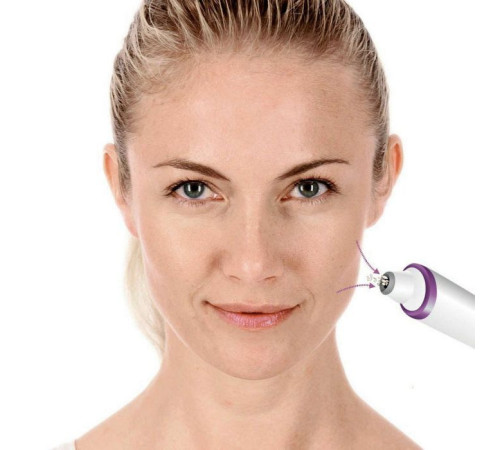 Прилад для чищення шкіри обличчя Beurer FC 76